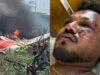 Air India Plane Crash: Lone Survivor Recalls Last Moments Of The Tragic Incident