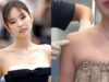 Shocking! Korean Woman Gets Shoulder Fillers To Recreate Jennie’s 90 Degree Shoulder Look