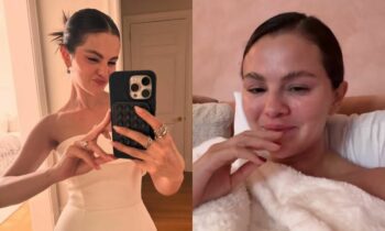 Selena Gomez Shocks Fans After Revealing She Has Melasma! Know What This Skin-Condition Means Selena Gomez Shocks Fans After Revealing She Has Melasma! Know What This Skin-Condition Means