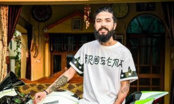 Anurag Dobhal Shows Stitches, Scars After Car Crash. Shocking