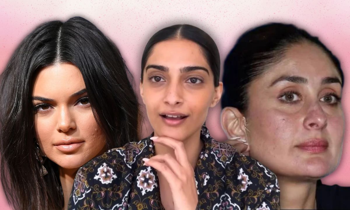 From Strawberry Legs To Dark Circles, We Need To Stop Treating Normal Skin Like Problem. Period!